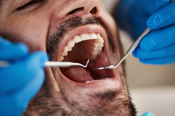Best Urgent Care for Lost Fillings or Crowns in Watertown, SD